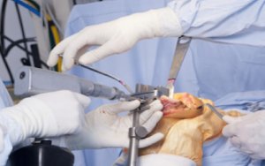 Australian Medical Device Firm Sirtex Accepts CHD’s $1.4B Acquisition Bid，澳大利亚医疗设备公司Sirtex接受中国鼎晖投资14亿美元收购报价