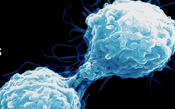 Alpine Immune Sciences Completes Sale of S-Nitrosoglutathione Reductase (GSNOR) Assets to Laurel Venture Capital，中国朗煜资本全盘收购美国Alpine Immune Sciences公司GSNOR抑制剂资产