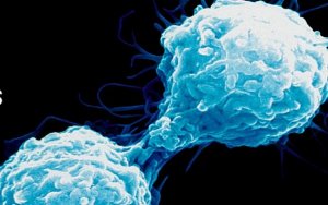 中国朗煜资本全盘收购美国Alpine Immune Sciences公司GSNOR抑制剂资产，Alpine Immune Sciences Completes Sale of S-Nitrosoglutathione Reductase (GSNOR) Assets to Laurel Venture Capital