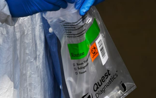 FDA授权奎斯特的新冠病毒试剂紧急使用授权，股价上涨